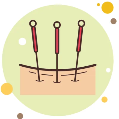 Acupuncture books