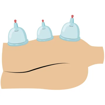 Cupping books